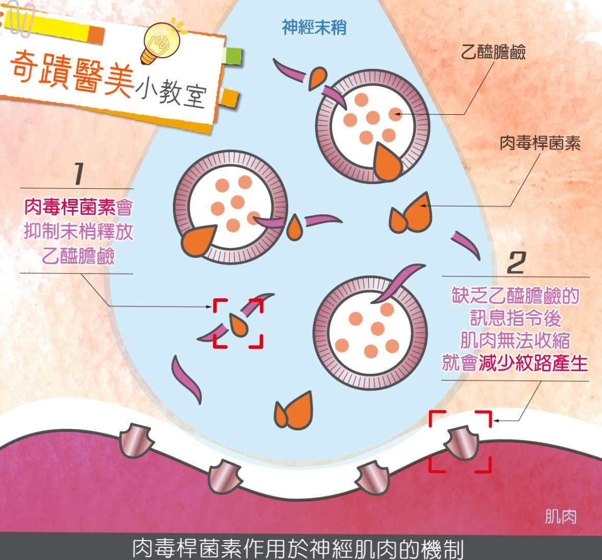 肉毒桿菌作用於神經肌肉的機制